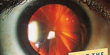 Ce type de chirurgie oculaire peut en fait aggraver la vision