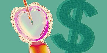 Le coût de la FIV peut être astronomique, mais il existe des alternatives abordables