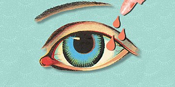 Ces femmes prennent des gouttes pour les yeux fabriquées à partir de leur propre sang après des complications de la chirurgie oculaire au laser