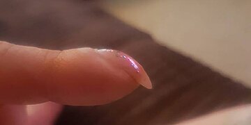 Cette femme a posté une photo de son ongle incurvé sur Facebook et n’avait « aucune idée » que c’était un signe de cancer