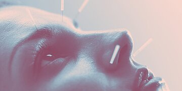 L’acupuncture est le remède naturel contre l’anxiété que vous voudrez peut-être essayer