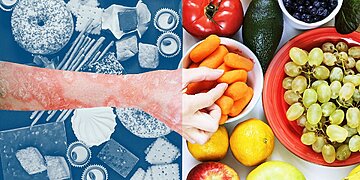 Existe-t-il un régime pour le psoriasis ? 5 Aliments qui peuvent être bénéfiques et 5 qui ne le sont probablement pas