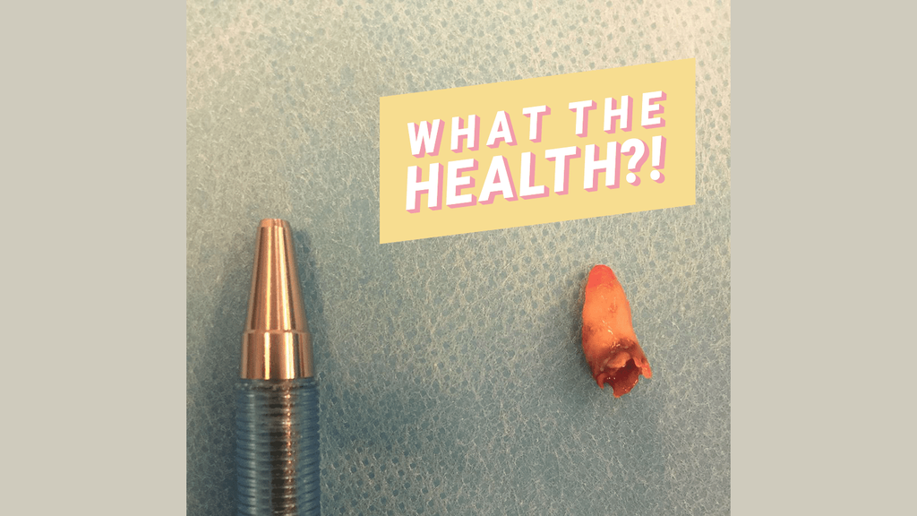 Le nez bouché de cet homme s’est avéré être une dent qui pousse dans ses sinus Le nez bouché de cet homme s’est avéré être une dent qui pousse dans ses sinus