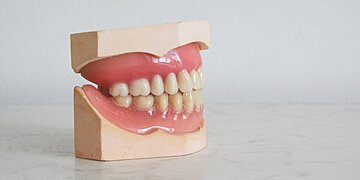 Qu’est-ce que l’hyperplasie gingivale ?