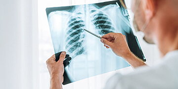 Les cas de tuberculose chez les enfants en Europe augmentent de manière préoccupante