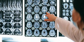 Sébastien Chabal amnésique : Le médecin du MHR choqué par la gravité de ses troubles neurologiques