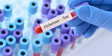 Un test de sang pour détecter et suivre l’évolution de la maladie