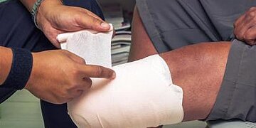 Douleur post-amputation : le moignon en question