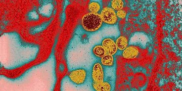 Mopevac : la nouvelle plateforme vaccinale de l’Institut Pasteur effectue son premier essai