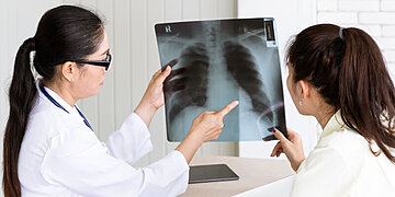 Mythe : le cancer du poumon touche aussi les non-fumeurs