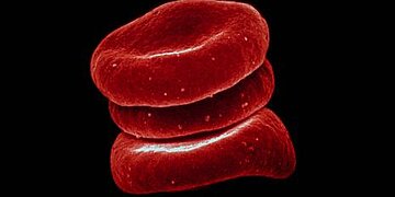 Faut-il prescrire des AOD en pleine ou demi-dose pour la prophylaxie après une TVP ?