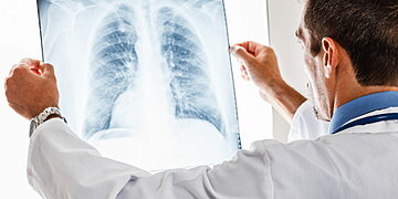 La pneumonie est une infection pulmonaire potentiellement mortelle dans certains cas