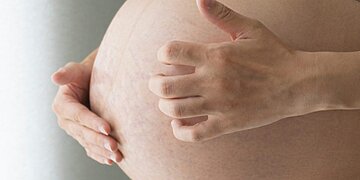 Une gynécologue décrit l’impact des vingt grossesses sur le corps d’une femme qui attend à nouveau
