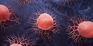 Néoplasie : explications, symptômes et traitements possibles