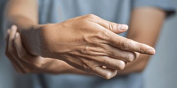 Quelles méthodes pour traiter la maladie de Dupuytren ?